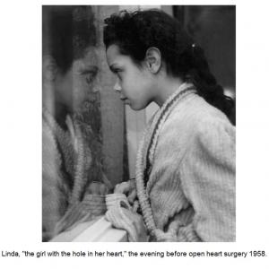 Linda, "the girl with the hole in her heart," the evening before open heart surgery, 1958